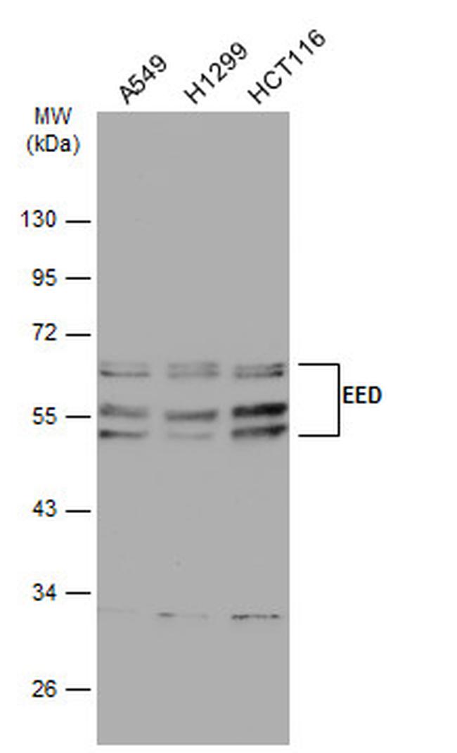 EED Antibody in Western Blot (WB)