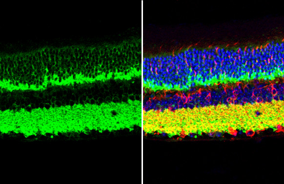 VAMP2 Antibody in Immunohistochemistry (Paraffin) (IHC (P))