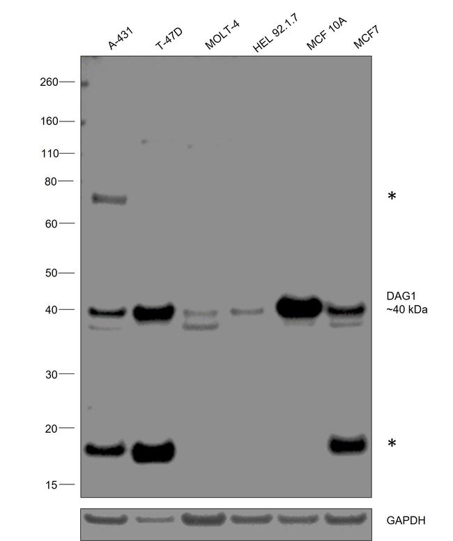 beta Dystroglycan Antibody in Western Blot (WB)