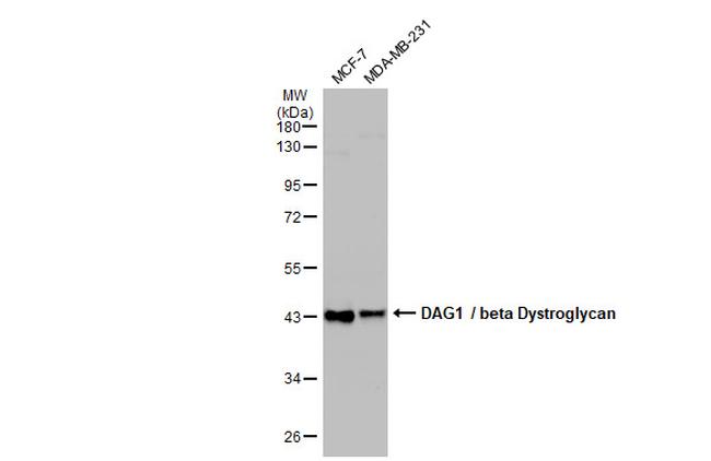 beta Dystroglycan Antibody in Western Blot (WB)