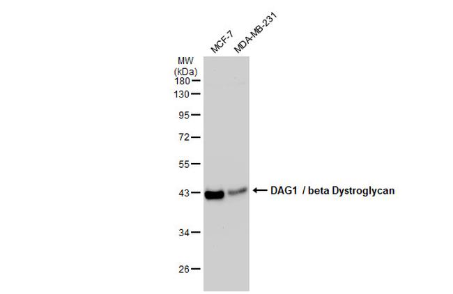 beta Dystroglycan Antibody in Western Blot (WB)