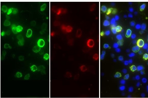 SARS-CoV/SARS-CoV-2 Nucleocapsid Antibody in Immunohistochemistry (Paraffin) (IHC (P))