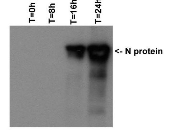 SARS-CoV/SARS-CoV-2 Nucleocapsid Antibody in Western Blot (WB)