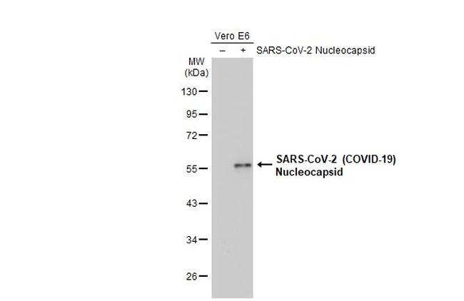 SARS-CoV/SARS-CoV-2 Nucleocapsid Antibody in Western Blot (WB)