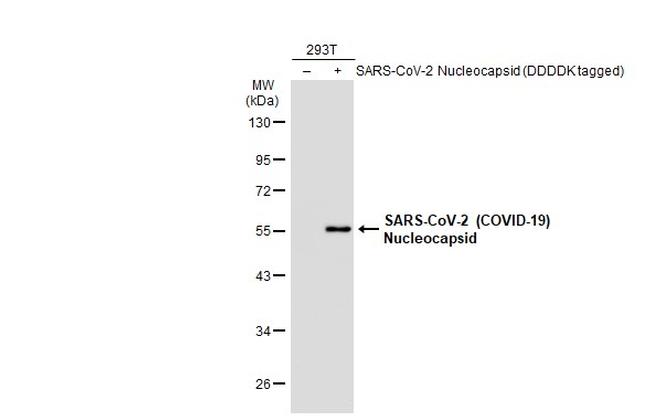 SARS-CoV/SARS-CoV-2 Nucleocapsid Antibody in Western Blot (WB)