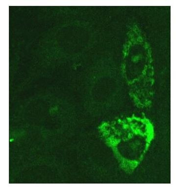 SARS-CoV/SARS-CoV-2 Nucleocapsid Antibody in Immunocytochemistry (ICC/IF)