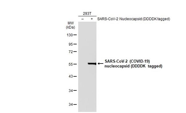 SARS-CoV/SARS-CoV-2 Nucleocapsid Antibody in Western Blot (WB)