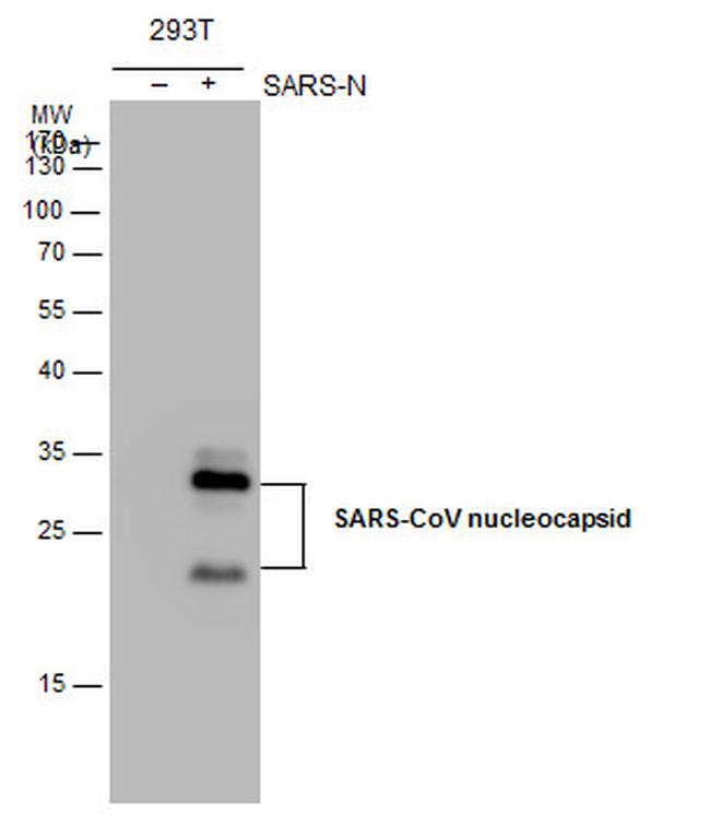 SARS-CoV/SARS-CoV-2 Nucleocapsid Antibody in Western Blot (WB)