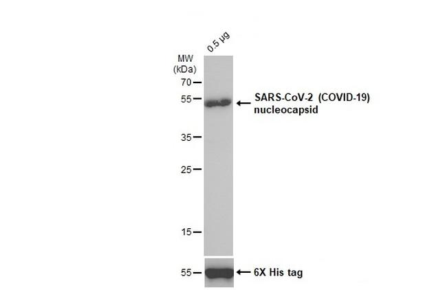 SARS-CoV/SARS-CoV-2 Nucleocapsid Antibody in Western Blot (WB)