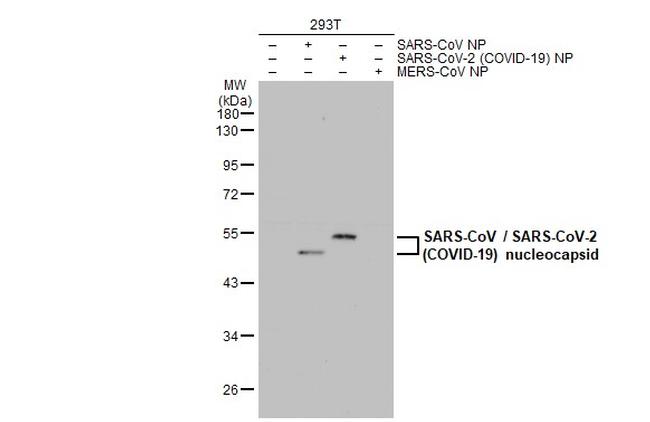 SARS-CoV/SARS-CoV-2 Nucleocapsid Antibody in Western Blot (WB)