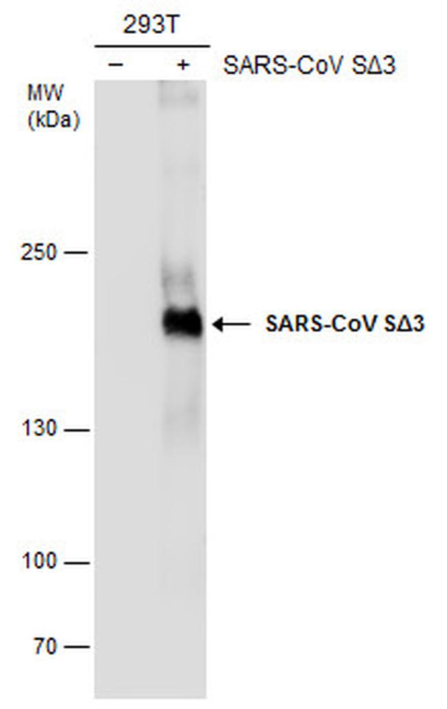 SARS-CoV Spike Protein (SDelta3) Antibody in Western Blot (WB)