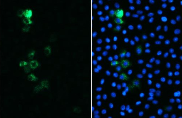 SARS/SARS-CoV-2 Spike Protein S2 Antibody in Immunocytochemistry (ICC/IF)