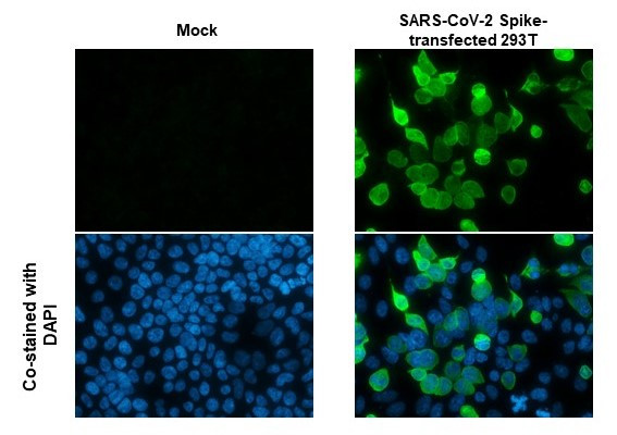 SARS/SARS-CoV-2 Spike Protein S2 Antibody in Immunocytochemistry (ICC/IF)