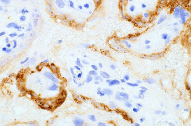 SARS/SARS-CoV-2 Spike Protein S2 Antibody in Immunohistochemistry (Paraffin) (IHC (P))