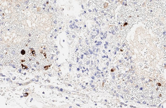 SARS/SARS-CoV-2 Spike Protein S2 Antibody in Immunohistochemistry (Paraffin) (IHC (P))