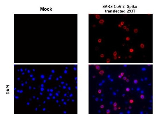 SARS/SARS-CoV-2 Spike Protein S2 Antibody in Immunohistochemistry (Paraffin) (IHC (P))