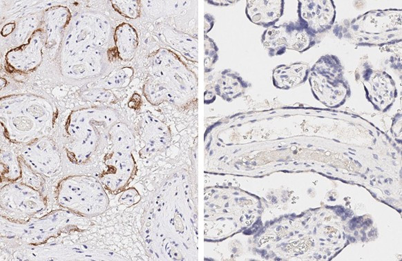 SARS/SARS-CoV-2 Spike Protein S2 Antibody in Immunohistochemistry (Paraffin) (IHC (P))