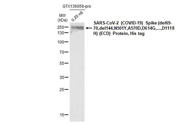 SARS/SARS-CoV-2 Spike Protein S2 Antibody in Western Blot (WB)