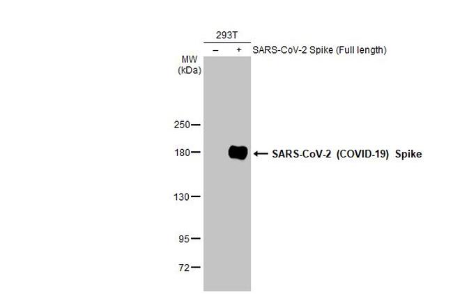 SARS/SARS-CoV-2 Spike Protein S2 Antibody in Western Blot (WB)