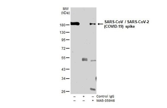 SARS/SARS-CoV-2 Spike Protein S2 Antibody in Immunoprecipitation (IP)