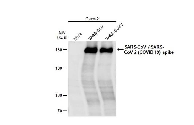 SARS/SARS-CoV-2 Spike Protein S2 Antibody in Western Blot (WB)