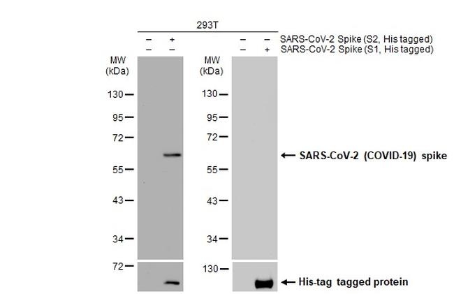 SARS/SARS-CoV-2 Spike Protein S2 Antibody in Western Blot (WB)