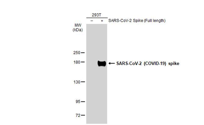 SARS/SARS-CoV-2 Spike Protein S2 Antibody in Western Blot (WB)