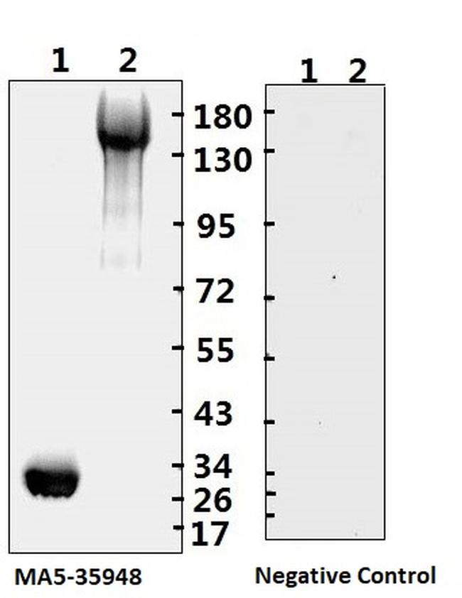 SARS-CoV-2 Spike Protein (S1/S2) Antibody in Western Blot (WB)