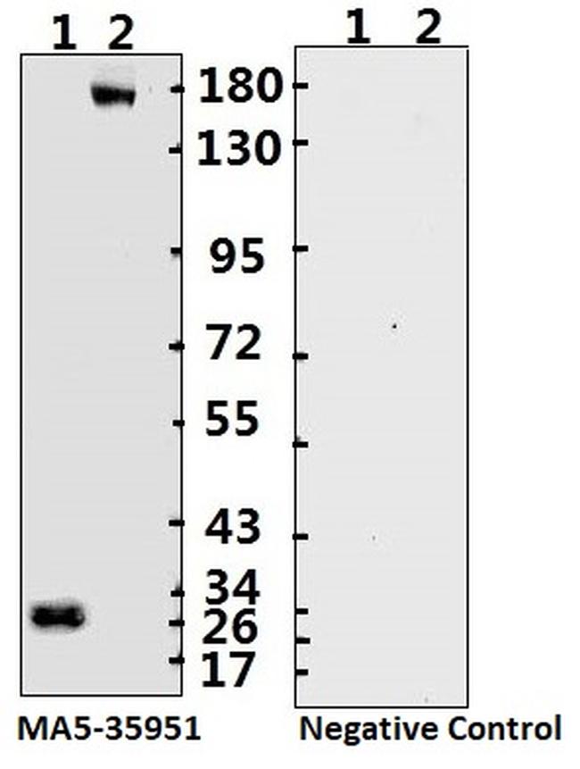 SARS-CoV-2 Spike Protein (S1/S2) Antibody in Western Blot (WB)