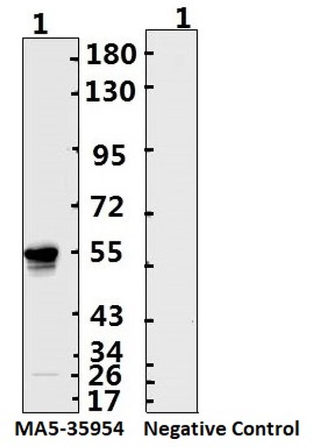 SARS-CoV-2 Nucleocapsid Antibody in Western Blot (WB)