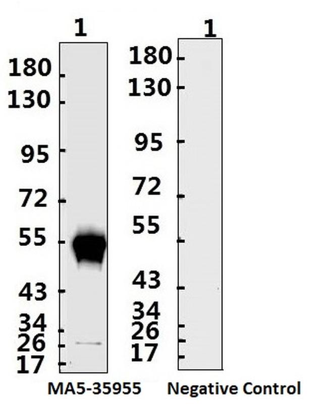 SARS-CoV-2 Nucleocapsid Antibody in Western Blot (WB)