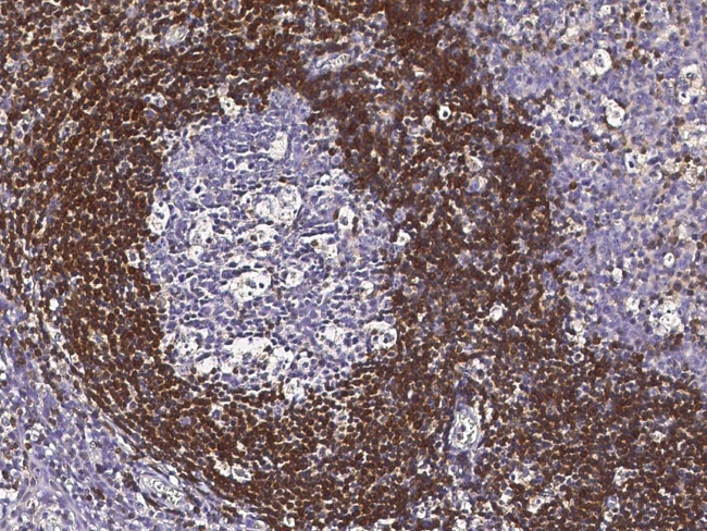 Bcl-2 Antibody in Immunohistochemistry (Paraffin) (IHC (P))