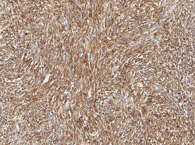 Bcl-2 Antibody in Immunohistochemistry (Paraffin) (IHC (P))