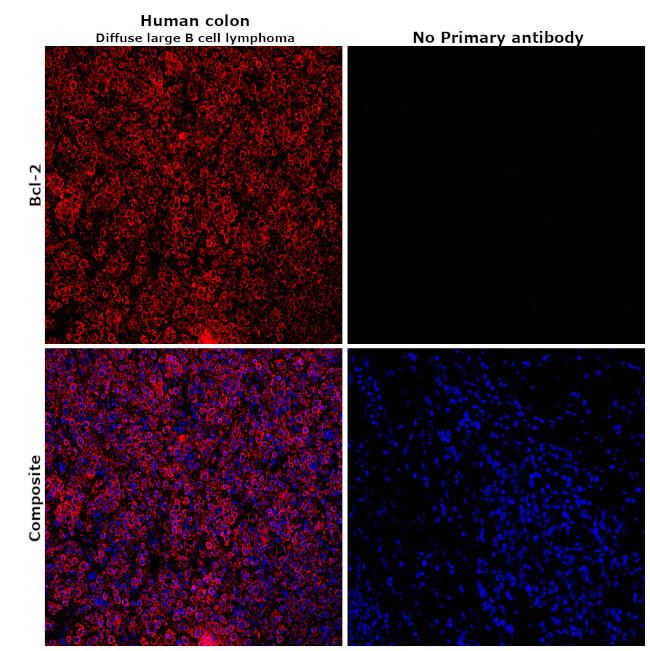 Bcl-2 Antibody in Immunohistochemistry (Paraffin) (IHC (P))