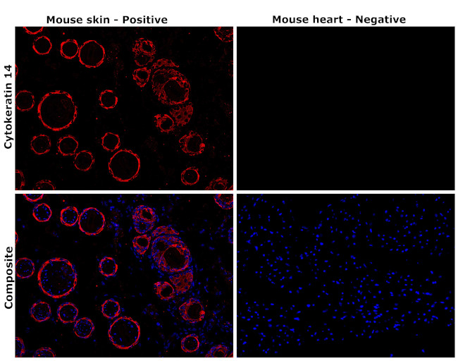 Cytokeratin 14 Antibody in Immunohistochemistry (Paraffin) (IHC (P))