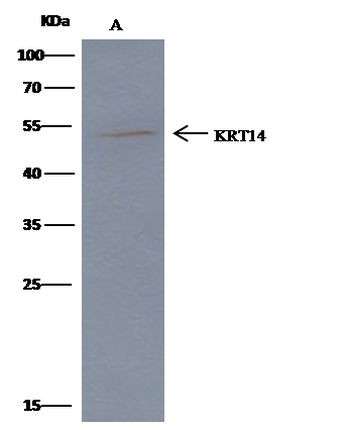 Cytokeratin 14 Antibody in Immunoprecipitation (IP)