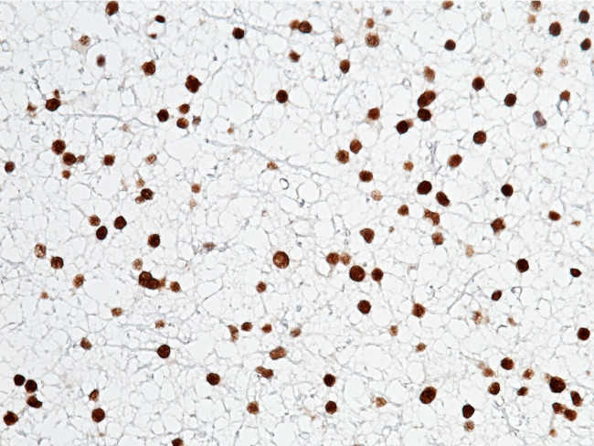 OLIG2 Antibody in Immunohistochemistry (Paraffin) (IHC (P))