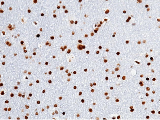 OLIG2 Antibody in Immunohistochemistry (Paraffin) (IHC (P))