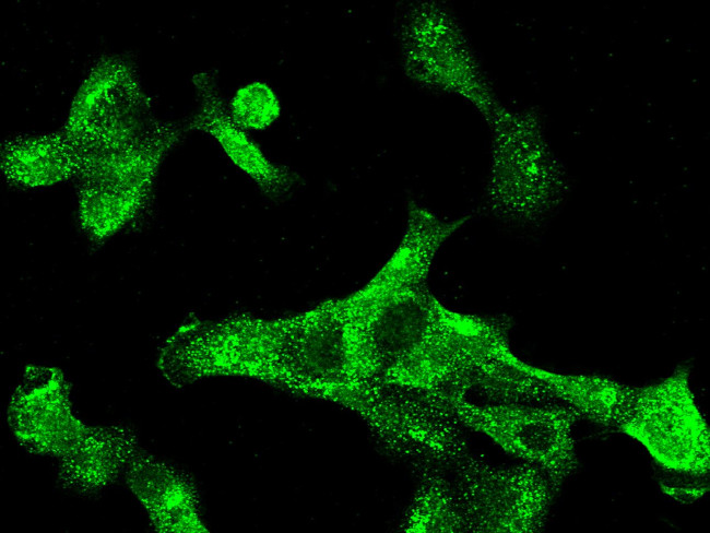 Cytokeratin 5 Antibody in Immunocytochemistry (ICC/IF)