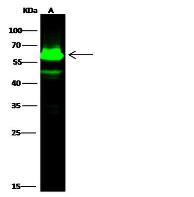 Cytokeratin 5 Antibody in Western Blot (WB)