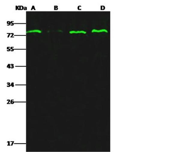 Estrogen Receptor alpha Antibody in Western Blot (WB)