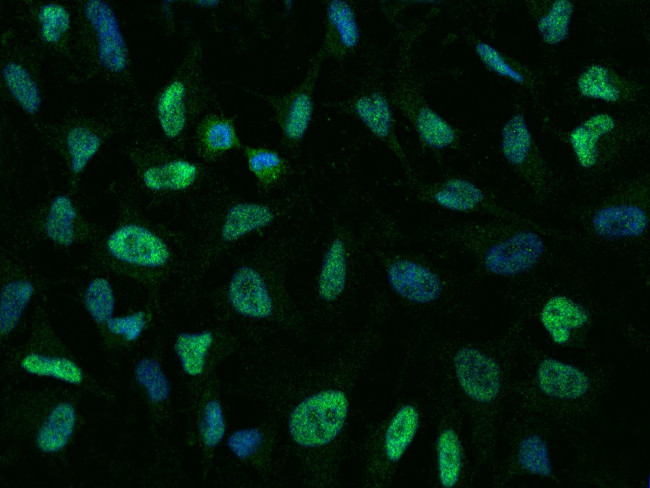 p38 MAPK alpha Antibody in Immunocytochemistry (ICC/IF)