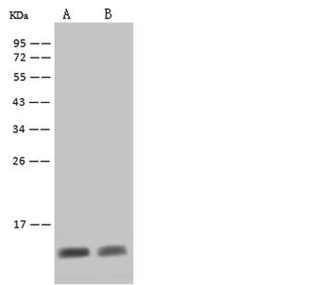 S100A8 Antibody in Western Blot (WB)