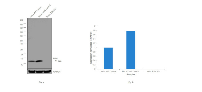 beta-2 Microglobulin Antibody