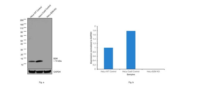 beta-2 Microglobulin Antibody in Western Blot (WB)