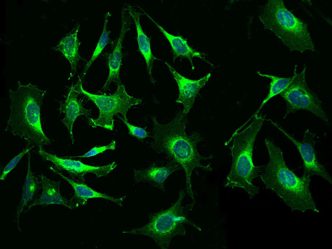 beta-2 Microglobulin Antibody in Immunocytochemistry (ICC/IF)