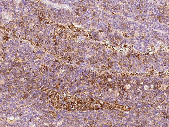 beta-2 Microglobulin Antibody in Immunohistochemistry (Paraffin) (IHC (P))