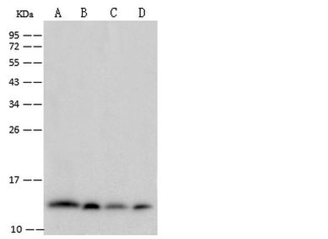 beta-2 Microglobulin Antibody in Western Blot (WB)