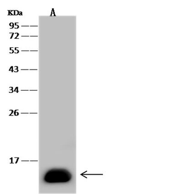 FABP1 Antibody in Western Blot (WB)