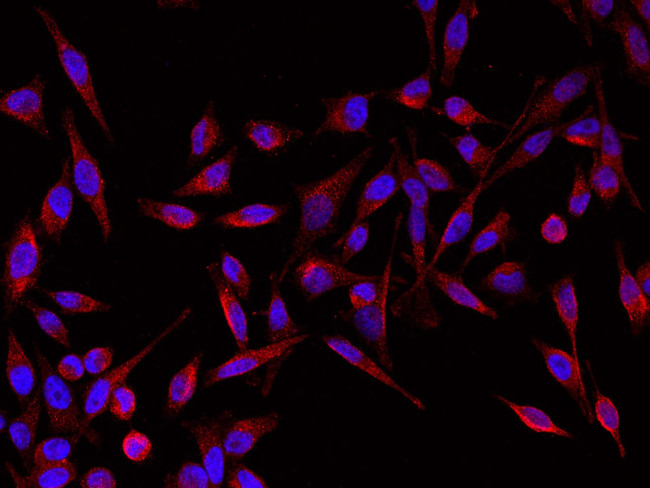 GIF Antibody in Immunocytochemistry (ICC/IF)